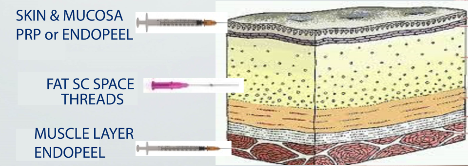 how to proceed for vulvar embellishment