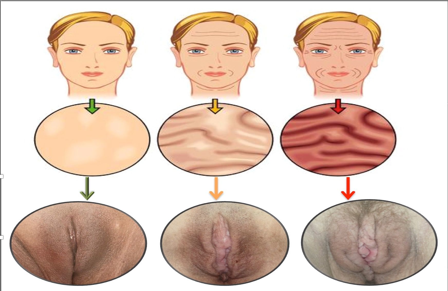 gyneco-aging