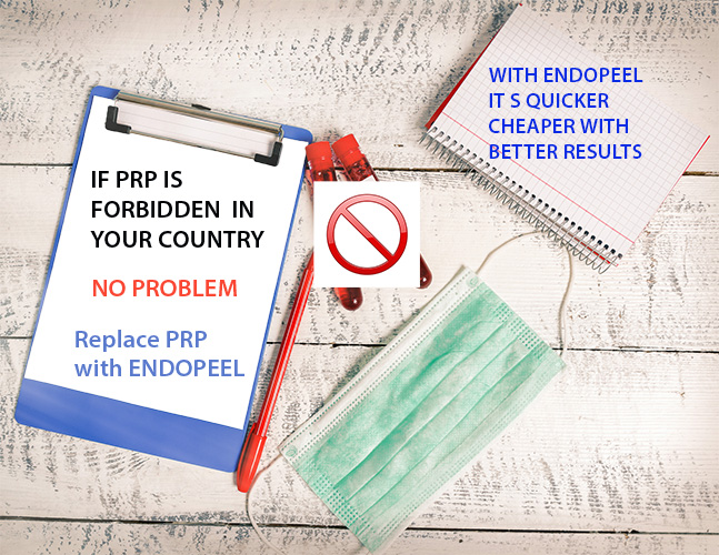 prp vs endopeel