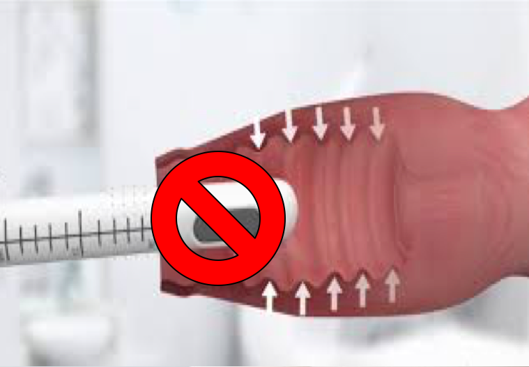 no hifu vaginal