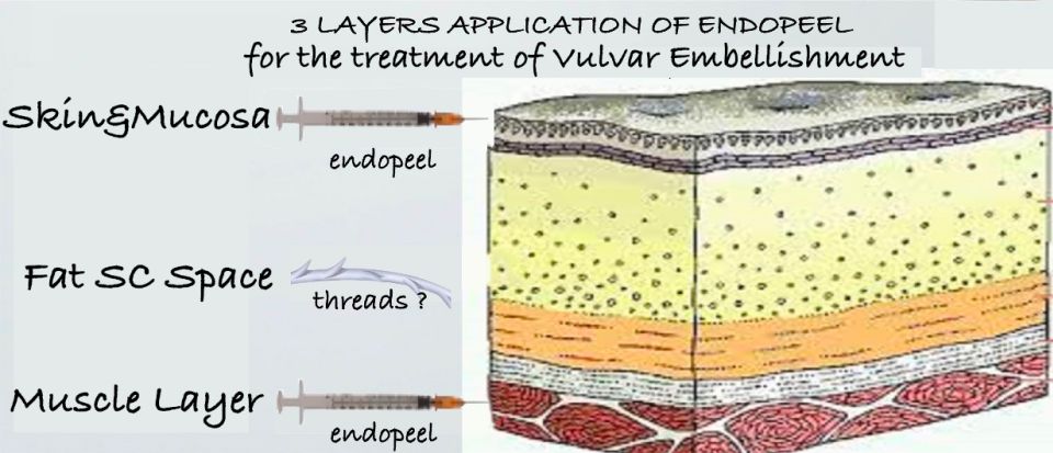 how to proceed for vulvar embellishment